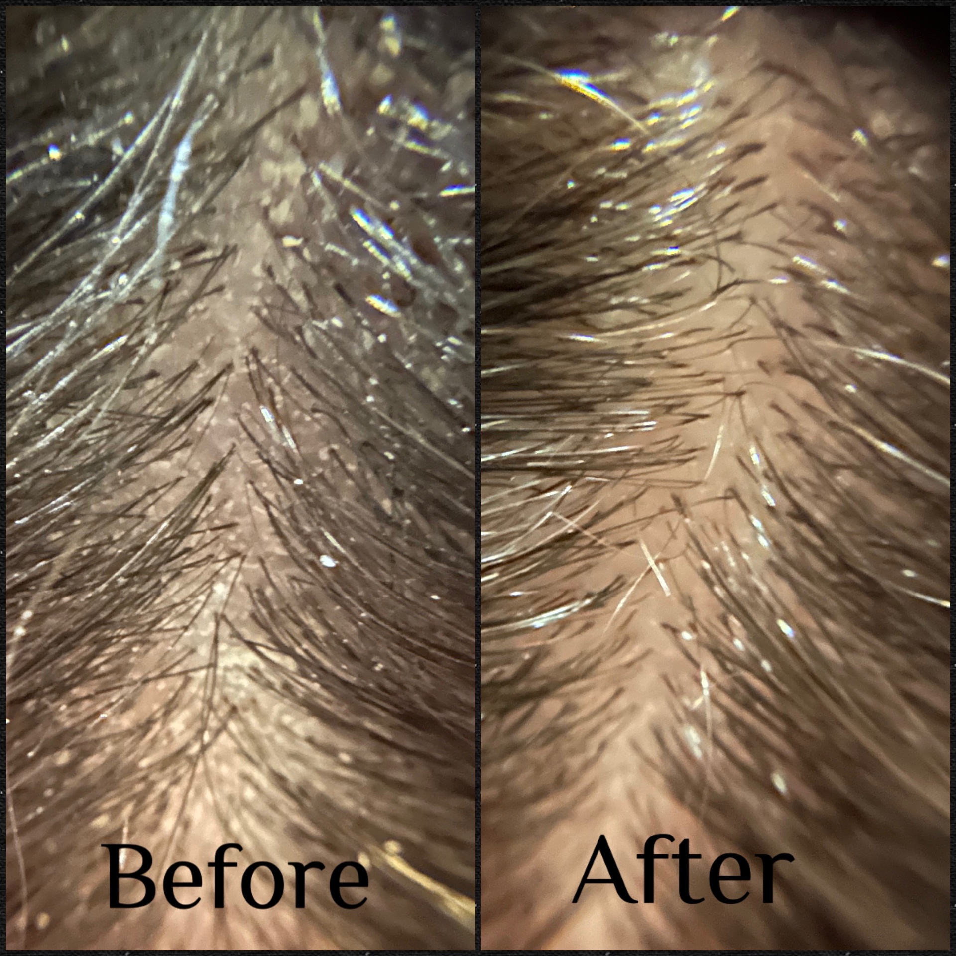 Scalp care results from a Japanese head spa treatment at HairPlay Spa OKC