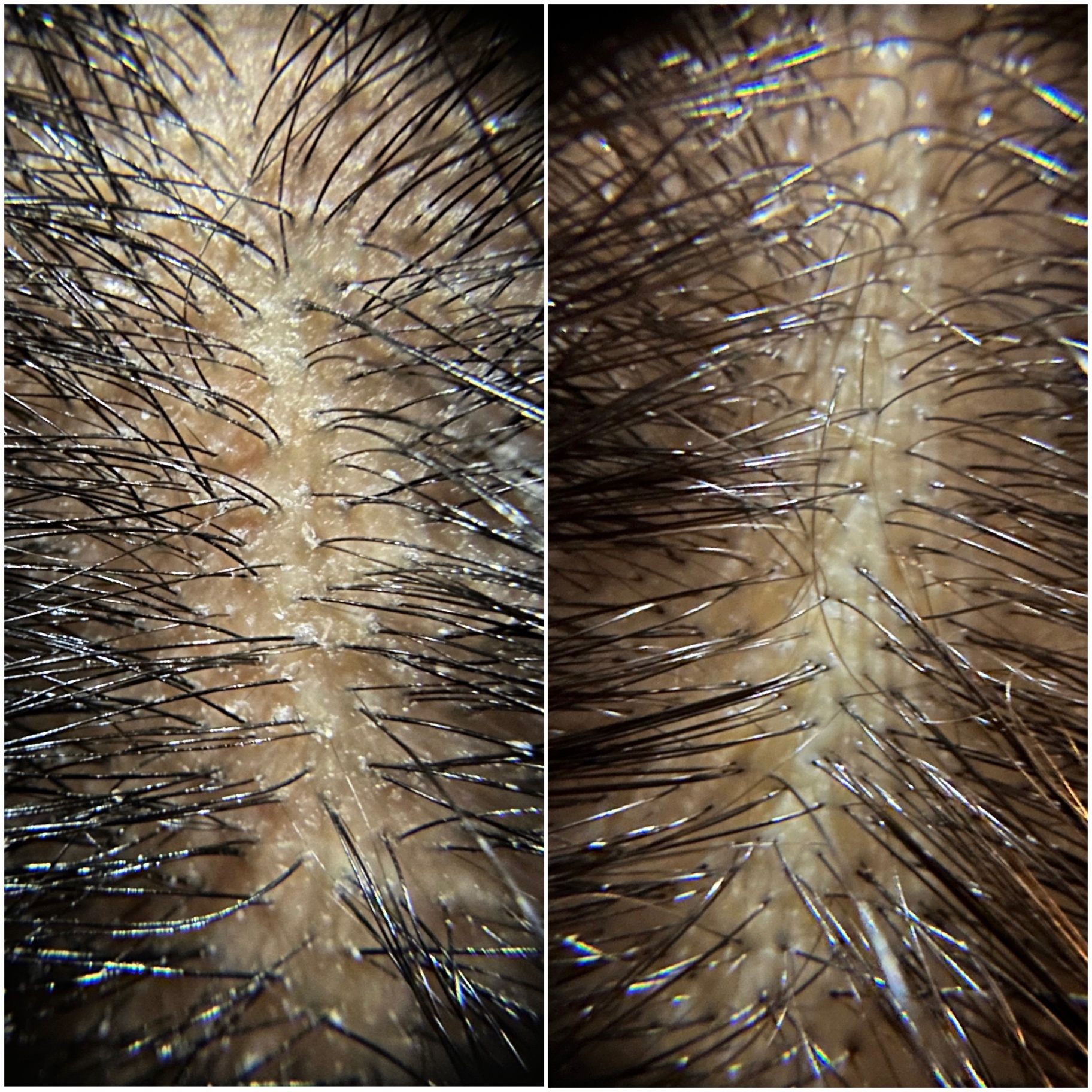 Close-up scalp cleansing results from a HairPlay Spa scalp treatment in OKC