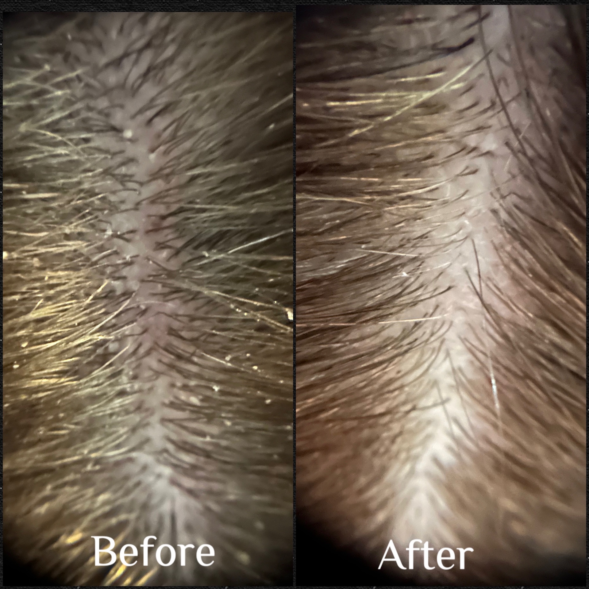 Scalp wellness progress photo from HairPlay Spa in Oklahoma City
