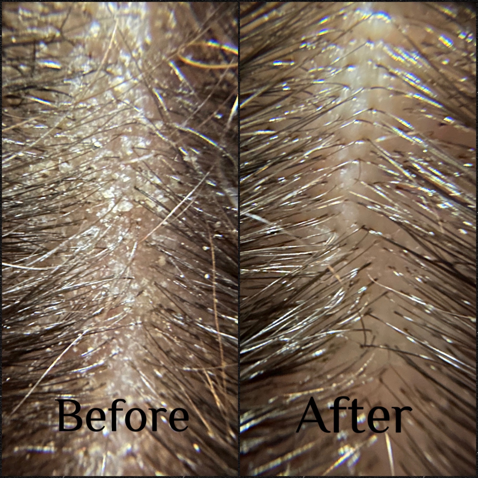 Before and after scalp transformation from a HairPlay Spa scalp treatment in Oklahoma City