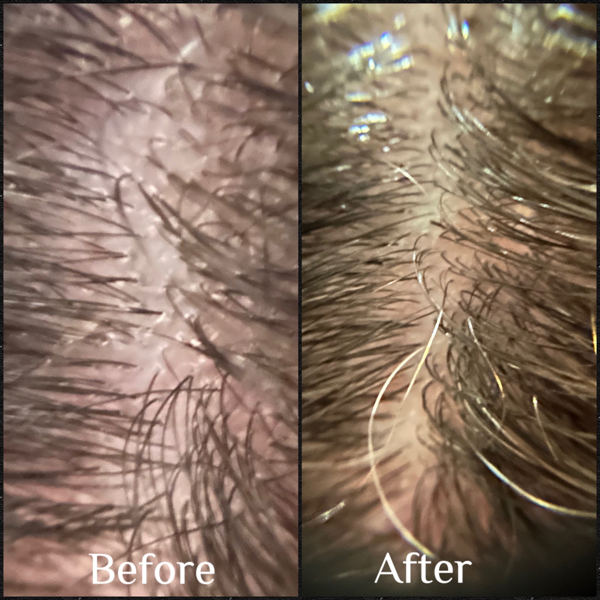 HairPlay Spa client scalp transformation result in Oklahoma City