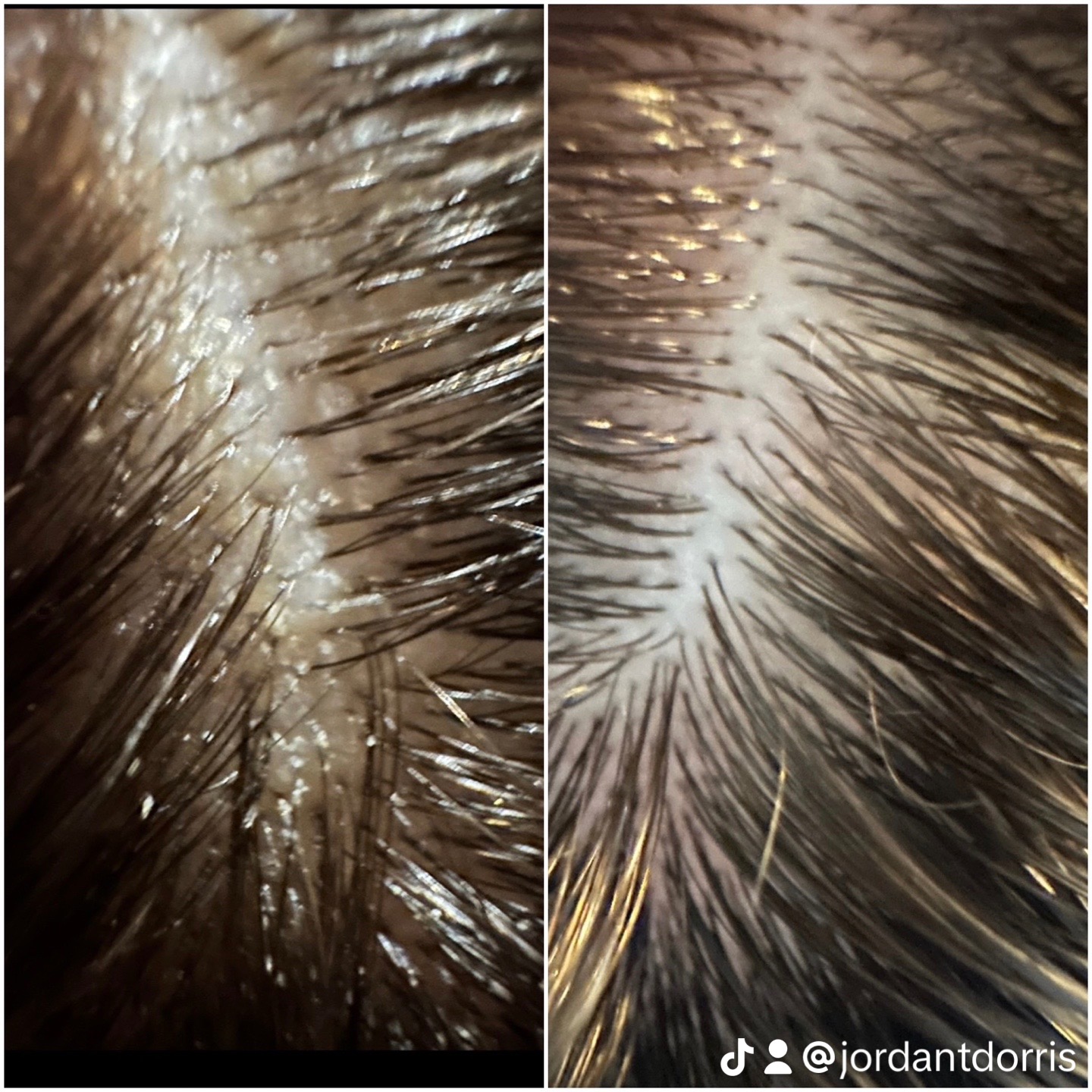Scalp comfort and clarity after a personalized HairPlay Spa scalp treatment in Oklahoma City